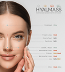 HYALMASS ULTRA Lidocaine 1X1ML - Aesthisave Pick